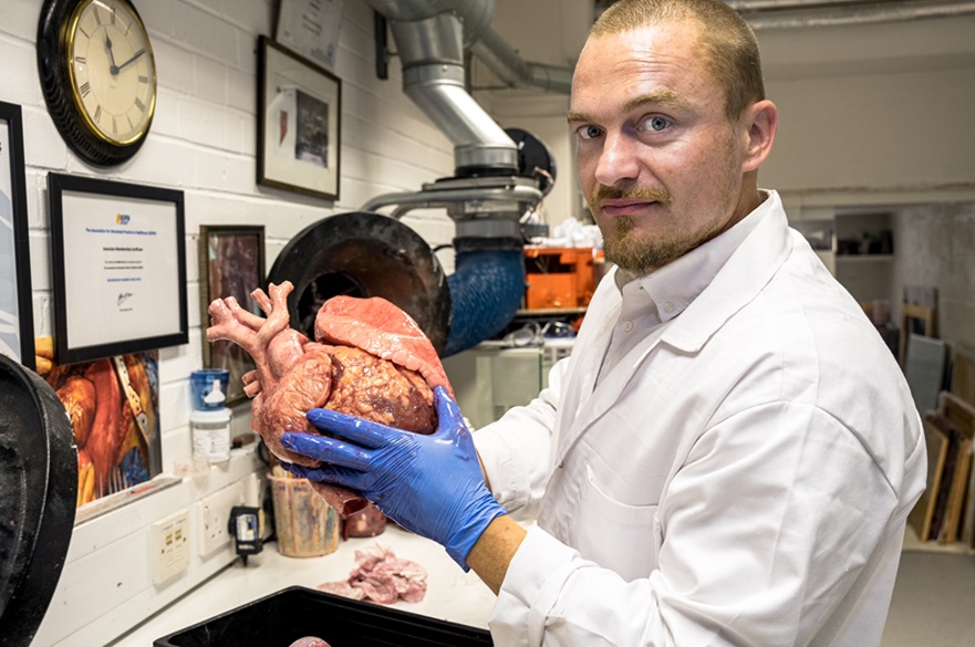 Le chercheur Richard Arm a utilisé les données d'un patient souffrant d'insuffisance cardiaque et d'un cœur de donneur sain pour imprimer en 3D des modèles réalistes.